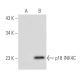 CDKN2C/p18 INK4c Antibody (18P118) - Western Blotting - Image 66128