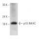 CDKN2C/p18 INK4c Antibody (B-2) - Western Blotting - Image 326522