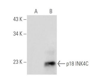 CDKN2C/p18 INK4c Antibody (DCS-118 ) - Western Blotting - Image 66126
