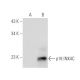 CDKN2C/p18 INK4c Antibody (DCS-118 ) - Western Blotting - Image 66126