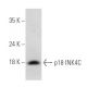 CDKN2C/p18 INK4c Antibody (H-7) - Western Blotting - Image 326521 