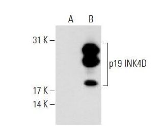 p19 INK4D/CDKN2D Antibody (3H2796) - Western Blotting - Image 62707