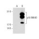 p19 INK4D/CDKN2D Antibody (3H2796) - Western Blotting - Image 62707
