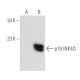 p19 INK4D/CDKN2D Antibody (A-4) - Western Blotting - Image 108955