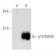 p19 INK4D/CDKN2D Antibody (D-9) - Western Blotting - Image 129835