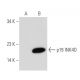 p19 INK4D/CDKN2D Antibody (E-11) - Western Blotting - Image 43957 