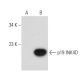 p19 INK4D/CDKN2D Antibody (E-3) - Western Blotting - Image 134045
