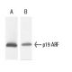 CDKN2A/p19ARF Antibody (12-A1-1) - Western Blotting - Image 9219 