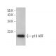 CDKN2A/p19ARF Antibody (12-A1-1) - Western Blotting - Image 377639 