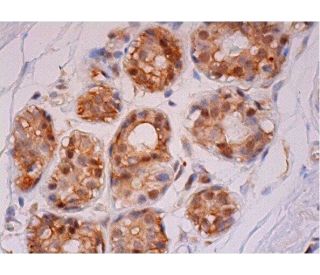 Waf1/Cip1/CDKN1A p21 Antibody (AC8.3) - Immunohistochemistry - Image 293344 