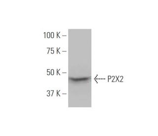 P2X2 Antibody (3D5) - Western Blotting - Image 347612 