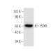 P2X5 Antibody (A-11) - Western Blotting - Image 308076 