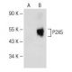 P2X5 Antibody (C-2) - Western Blotting - Image 147979 