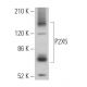 P2X5 Antibody (C-2) - Western Blotting - Image 367334 