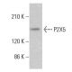P2X5 Antibody (C-2) - Western Blotting - Image 382855