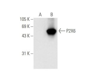 P2X6 Antibody (D-1) - Western Blotting - Image 62689