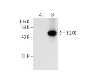 P2X6 Antibody (H-6) - Western Blotting - Image 62691