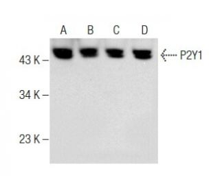 P2Y1 Antibody (E-1) - Western Blotting - Image 283475 