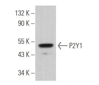 P2Y1 Antibody (E-1) - Western Blotting - Image 362872Each CRISPR/Cas9 Knockout (KO) Plasmid product consists of a pool of 3 plasmids designed to ensure identification and cleavage of a specific gene for maximum knockout efficiency. Each plasmid encodes a unique 20 nt sequence derived from the GeCKO (v2) library.