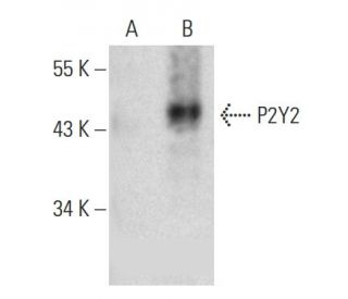 P2Y2 Antibody (E-3) - Western Blotting - Image 385936 