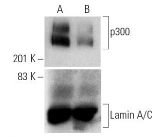 p300 siRNA (h): sc-29431. Western blot analysis of p300 expression in non-transfected control (A) and p300 siRNA transfect 