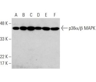 western blotting image from recommended p38 alpha/beta MAPK (A-12) monoclonal antibody replacement. Image 384072