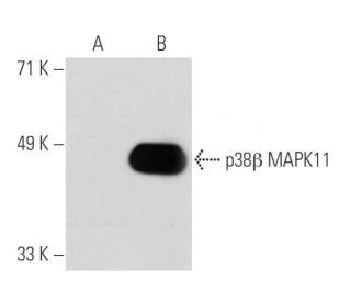 p38 beta MAPK11 Antibody (4H6H6) - Western Blotting - Image 31501 