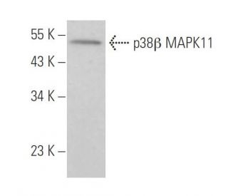 p38 beta MAPK11 Antibody (4H6H6) - Western Blotting - Image 377316