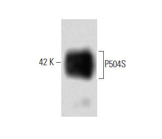 P504S Antibody (15) - Western Blotting - Image 60397
