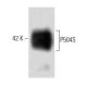 P504S Antibody (15) - Western Blotting - Image 60397