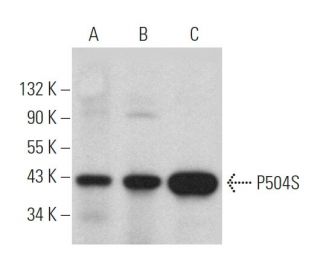 P504S Antibody (2A10F3) - Western Blotting - Image 374514 