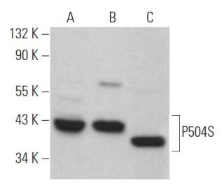 P504S Antibody (G-8) - Western Blotting - Image 364466 