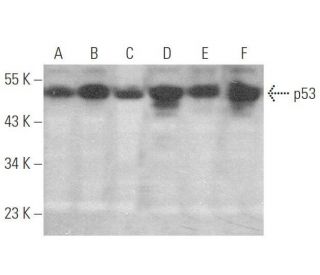 p53 Antibody (Bp53-12) - Western Blotting - Image 349924 