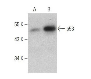 p53 Antibody (pAb 122) - Western Blotting - Image 376887 