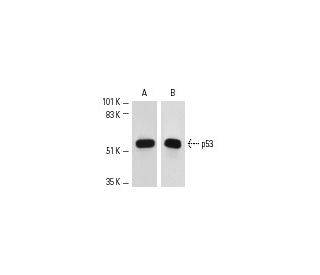 p53 Antibody (Pab 1801) - Western Blotting - Image 1670