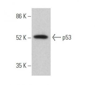 p53 Antibody (A-1) - Western Blotting - Image 373963
