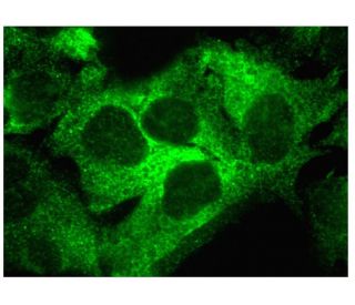 p53R2 Antibody (B-10) - Immunofluorescence - Image 293906 