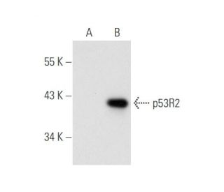 p53R2 Antibody (H-3) - Western Blotting - Image 58754