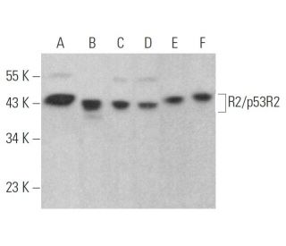 R2/p53R2 Antibody (F-9) - Western Blotting - Image 354429