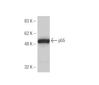 p55 Antibody (51-B) - Western Blotting - Image 53872 