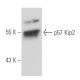 p57 Kip2 Antibody (3F244) - Western Blotting - Image 17430