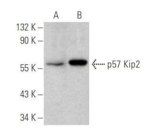 p57 Kip2 Antibody (3F244) - Western Blotting - Image 353697 