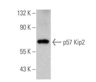p57 Kip2 Antibody (3F245) - Western Blotting - Image 353716 