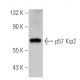 p57 Kip2 Antibody (3F245) - Western Blotting - Image 353716 