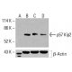 p57 Kip2 抗體 (H-12):sc-515909。Western blot 分析未處理 HeLa (A)、化學處理 HeLa (B)、K-562 (C) 及 HCT-116 (D) 整細胞裂解液中 p57 Kip2 之表現。檢測試劑:m-IgGκ BP-HRP:sc-516102。β-肌動蛋白(C4):sc-47778 用作載量對照。檢測試劑:m-IgG Fc BP-HRP:sc-525409。 p57 Kip2 Antibody (H-12) - Western Blotting - Image 416121