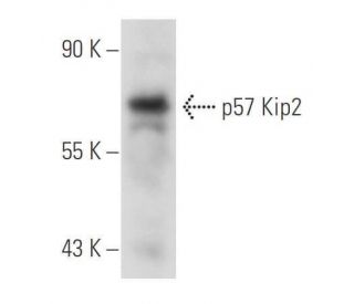 p57 Kip2 Antibody (KP39) - Western Blotting - Image 44027 