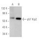 p57 Kip2 Antibody (SPM308) - Western Blotting - Image 353698 
