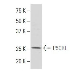 P5CRL Antibody (E-63) - Western Blotting - Image 33858The Double Nickase Plasmid features a U6 promoter for sgRNA expression, a 20 nt targeting sequence, and a gRNA scaffold to guide Cas9n. It includes a CBh promoter for Cas9n (D10A) and puromycin resistance, GFP for transfection verification, and nuclear localization signals (NLS). The 2A peptide allows co-expression of Cas9n and Puro from a single promoter, enabling precise genome editing with reduced off-target effects.