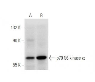 p70 S6 kinase/S6K1 Antibody (D-4) - Western Blotting - Image 320894 