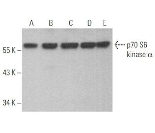 p70 S6 kinase/S6K1 Antibody (H-9) - Western Blotting - Image 353331 